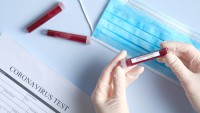 Corona-Virus Informationen zu laufenden Förderungen